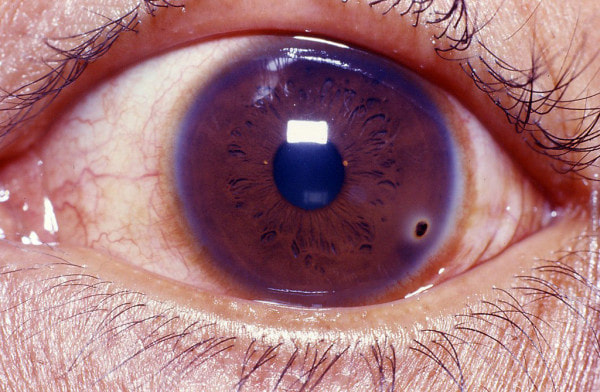 Urgencias oftalmologia